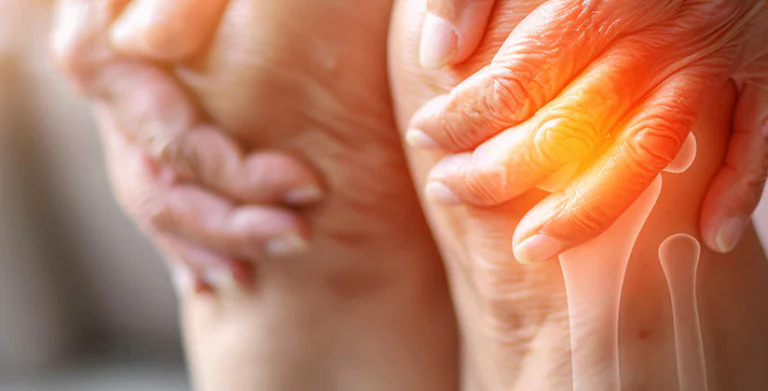 La kiné peut-elle soulager la polyarthrite ? La kiné peut-elle soulager la polyarthrite ?