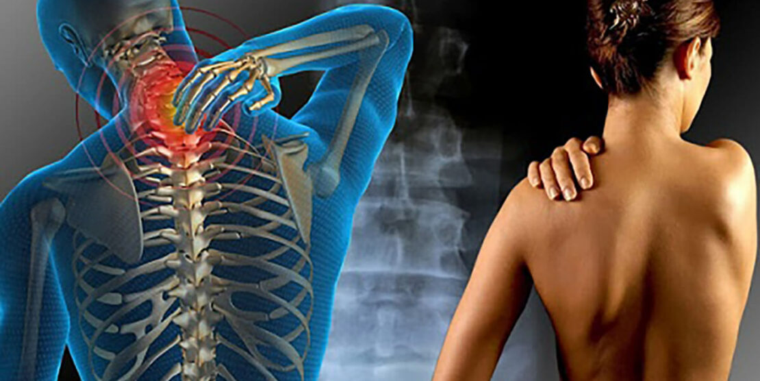 Fibromyalgie : La kinésithérapie, un allié de poids pour briser le cercle de la douleur Fibromyalgie : La kinésithérapie, un allié de poids pour briser le cercle de la douleur